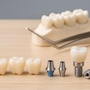 하나로치과기공소 이미지