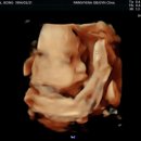 수서나을산부인과의원 이미지