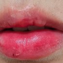 블러썸 이미지