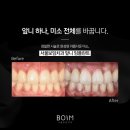 서울보임치과의원 네이버블로그