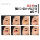 거울보고 화낼필요 없이 당장 도움받은 분당얼굴리프팅 로즈앤성형외과