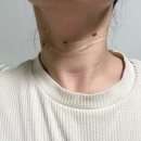 신논현 쁨 의원 목주름 필러 찐 후기 예쁨 목주사 필로드 목 스킨부스터+스킨보톡스 (부작용,다운타임...