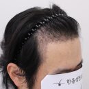 더헤어라인성형외과의원 이미지