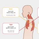 침삼킬때 목통증 목이아플때 이미지