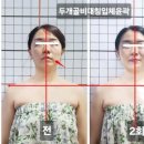 1회만으로도달라지는연예인얼굴윤곽관리 , 작은얼굴 V 라인관리 ,내돈내산 강미경스킨앤바디 3번째방문후기
