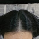 목동역 모가인SMP 두피문신 대만족 후기 2/2