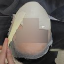 강남역 코레지 리프팅 후기 &#34;뉴케이의원&#34; - 자극없고 통증없는 피부타이트닝!