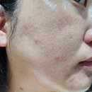 블루비타 | 🔵 고농축 비타민C 25% 함유! 루아셀 비타엑소 블루앰플 솔직 사용 후기💧