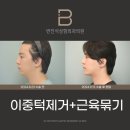 변진석성형외과의원 이미지