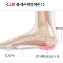 걸을 때 발바닥 중앙 찌릿 통증 원인 이미지