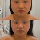 루아뷰티 - 군산시 | 서산 윤곽관리 /서산 루아뷰티 (ㄹㅇ후기)