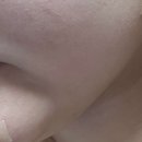 정담피부과의원 티스토리