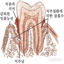 국내 최고품질을 지향하는 치과부문 샤크리움,프리크린의 20년간 검증된 표준화된 제품 구매문의 02...