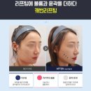 클린업피부과청담점 이미지