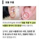 "거울 잠깐만 보고 가실께요" 얼굴만 봐도 알 수 있는 심혈관질환 전조증상 3가지 이미지