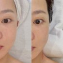 이마트24 파주운정점 | 파주 운정 피부관리 미담 에스테틱 경락 윤곽관리 재방문 후기