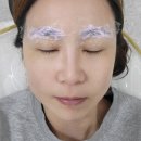 블레스옴 이미지