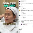 주신프라자 | 울쎄라 1000샷 - 이중턱 집중 공략 후기! (+벡트라 분석)[휴먼피부과 강서]