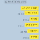 양수3 | 인천 아인병원 양수과소증 유도분만 성공 후기 3대굴욕 관장 내진 제모 진통