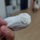 살랑메디 이미지