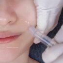 아리스킨케어 | 마포피부관리 후기, 고혹미 슈퍼젝션으로 피부장벽 케어