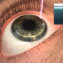 세란안과의원 이미지