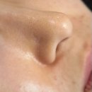 여름철 수부지의 블랙헤드 집중케어! 선릉역 피부관리 뷰티크나인스킨앤왁싱 후기