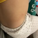 엑시마 이미지