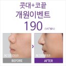더코성형외과 이미지
