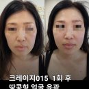 바르델
