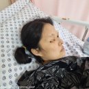 [담낭절제술] (2) 대동병원 외과, 담석증, 담낭염으로 담낭절제술을 받다... 이렇게 아플일?_적나라한...