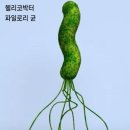 위암발생 억제방법 이미지