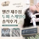 웰킨 - 용인시 수지구 | 제주두피케어, 제주 노형 두피관리 웰킨 제주점 솔직후기