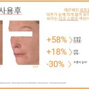 유정피부관리