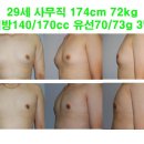 29세 사무직 직장인 174cm 72kg 중간사이즈 여유증 이미지