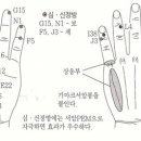 엉덩이 관절통증 이미지