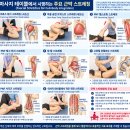 근막 스트레칭으로 치료를 마무리하는 방법 손의 부담은 줄이고, 전신의 움직임은 연결하는 근막이완 스트레칭. 이미지