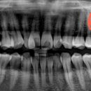 연세화이트치과의원 이미지