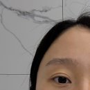 파크리움 (구:강남빌딩) | [강남] 실크 스마일라식/라섹/라식/내돈내산 스마일라식 후기