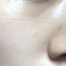 뉴로즈 이미지