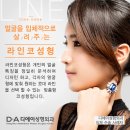 잘하는성형외과 Daum카페