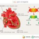 부정맥 원인과 증상. 치료 이미지