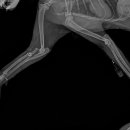 Monteggia fracture 이미지