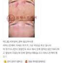 리하스킨케어 이미지
