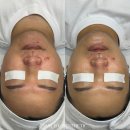 (유)청수기업 | 천안 청당동 '메이비유에스테틱': 세멘도소 케어 체험기