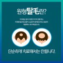 원형탈모 주사 부산 나비한의원 치료는
