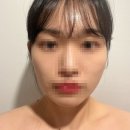 AWOON 아운