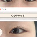 티나나안나나
