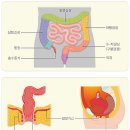 변비와 영양 이미지