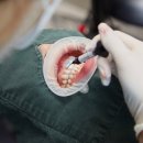 에센스치과기공소 | 부산 해운대 임플란트치과, 잘하는 5곳 소개합니다